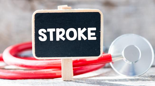 Penyakit stroke (Shutterstock)
