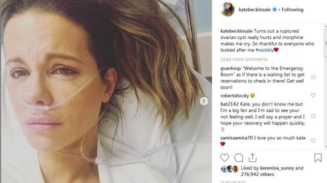 Kate Beckinsale dirawat di rumah sakit karena kista ovarium yang pecah. (Instagram)