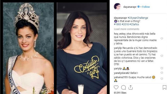 Periksa Tahi Lalat, Mantan Miss Universe Ini Ternyata Kena Kanker Kulit