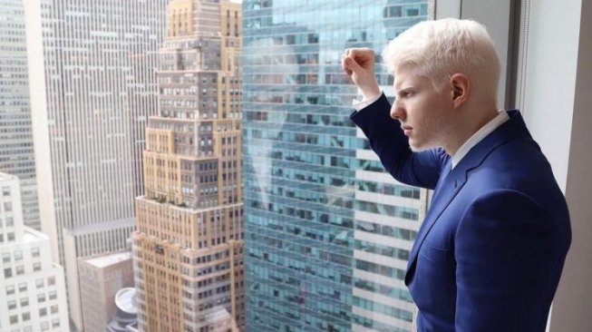 Bera Ivanishvili, model albino paling ganteng sejagat raya. (Instagram/@beraofficial)