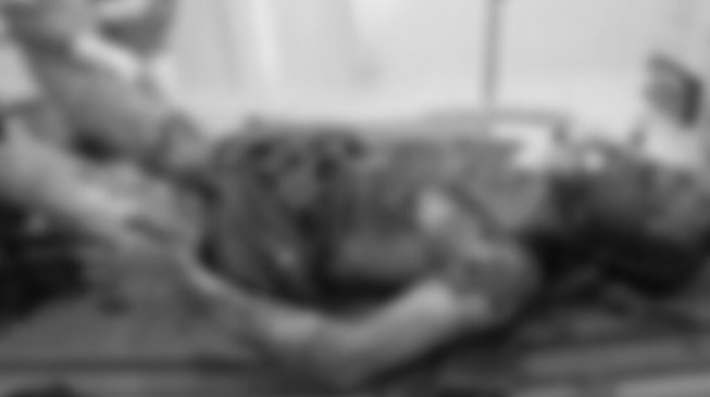 Herdam, Korban Kebakaran Sumur Minyak Ilegal Akhirnya Meninggal Dunia
