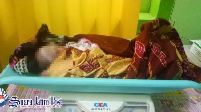 Ibu Kubur Bayi Hidup-hidup di Purwakarta karena Alami Baby Blues Syndrom