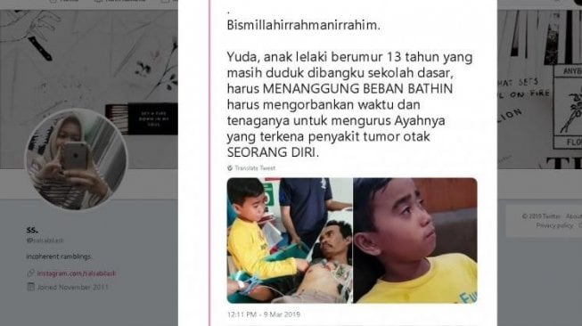 Kisah Pilu Bocah 12 Tahun Rawat Ayahnya yang Sakit Tumor Otak Seorang Diri