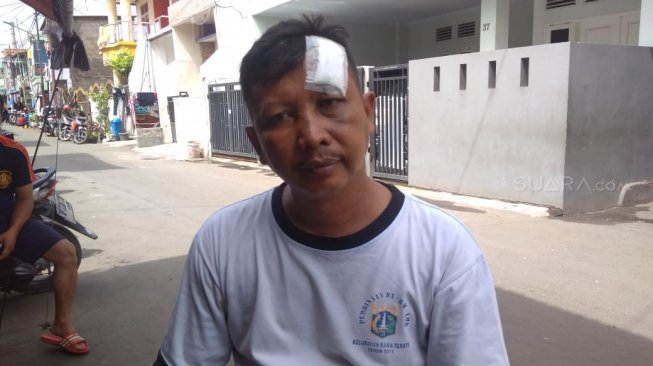Agus Salim ikut dibacok geng 3 Serangkai Kampung Jengkol, Cakung, Jakarta Timur, Minggu (17/3/2019) lalu. (Suara.com/Fakhri)