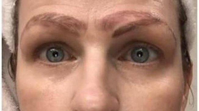 Gagal Total Jalani Microblading, Perempuan Ini Jadi Punya 4 Alis