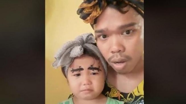 Alis Bayi Ini Bentuknya Mirip Cicak, Kok Bisa?