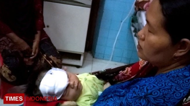 Bayi di Probolinggo Cidera Serius Diserang Kera