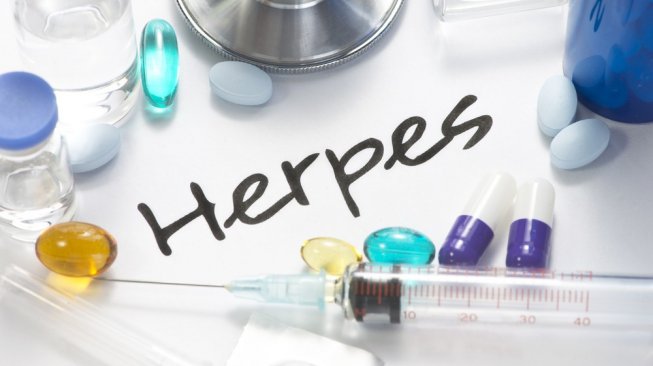 Ilustrasi pengobatan penyakit herpes. (Shutterstock)