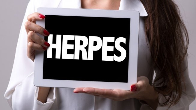 Ilustrasi pengobatan penyakit herpes. (Shutterstock)