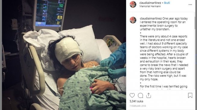 Claudia Martinez alami penyakit otak bawaan (Instagram/Caludia Martinez)