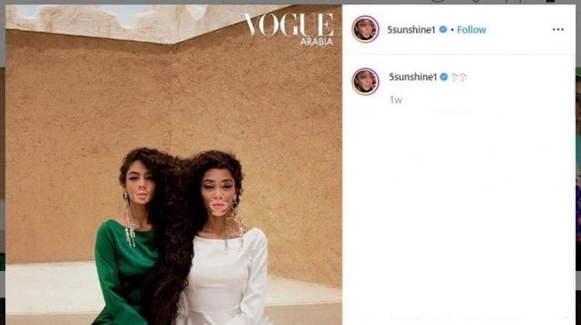 Punya Kelainan Kulit, Model Vitiligo Ini Hiasi Cover Majalah Vogue Arab