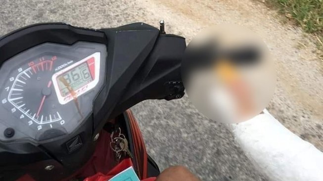 Patah Tulang Tangan Kanan, Trik Unik Naik Motor Ini Bikin Salah Fokus