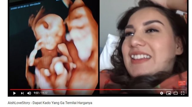 Irish Bella hamil anak kembar (Youtube/AishTV)