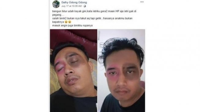 Jarang Pegang Istri karena Ketagihan Main Ponsel, Wajah Suami Jadi Begini