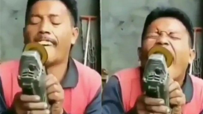 Bukan Ke Dokter Gigi, Pria Ini Punya Cara Sendiri Buat Ratakan Giginya