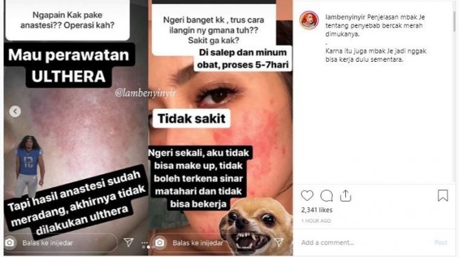 Wajah Jessica Iskandar rusak. (Instagram/@lambenyinyir)