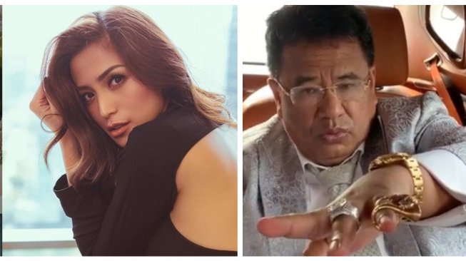 3 Berita Terpopuler: Wajah Rusak Jessica Iskandar - Hotman Lawan Elza