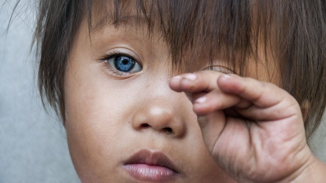 Bocah dengan bola mata berwarna biru Amelia Anggraeni bermain di teras rumah di kawasan Bandung, Jawa Barat, Sabtu (7/9). [ANTARA FOTO/Novrian Arbi]