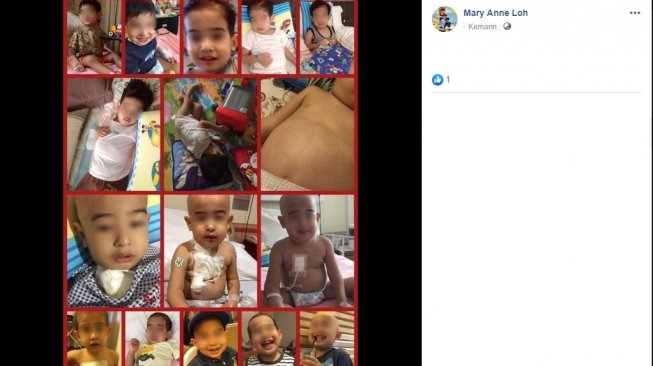 Ethan, anak penderita leukemia (Facebook/Mary Anne Loh)