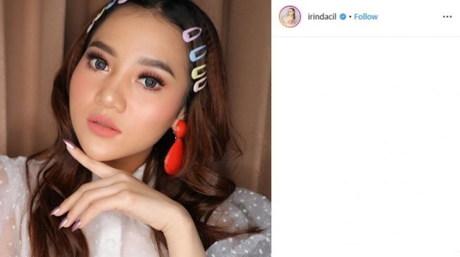 Kelebihan Hormon Pria, Irine Mantan Peserta Idol 2018 Derita PCOS