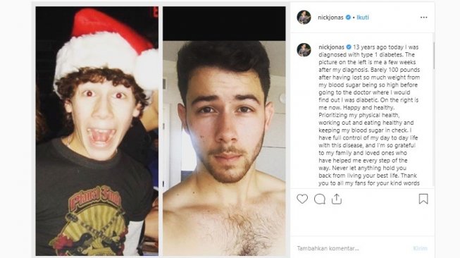 Nick Jonas menceritakan dirinya idap diabetes tipe 1 (Instagram/Nick Jonas)