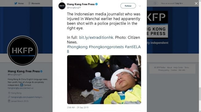 Jurnalis Indonesia tertembak di Hong Kong - (Twitter/@HongKongFP)