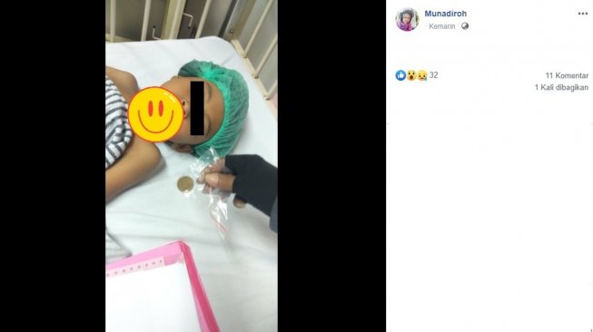 Kondisi anak yang menelan koin (Facebook/Munadiroh)