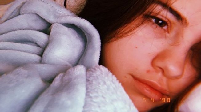 Wajah bareface Selena Gomez. (Instagram/@selenagomez)