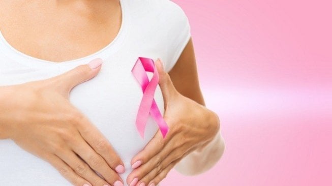 Ilustrasi kanker payudara. (Shutterstock)