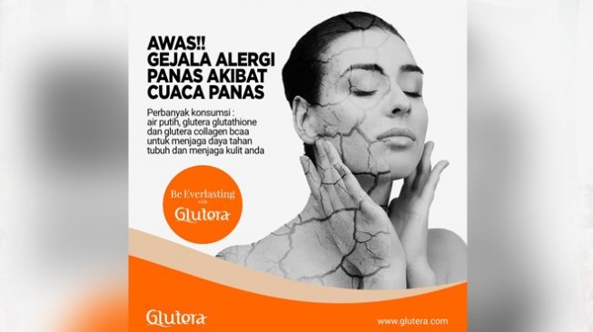 Waspadai, Alergi Panas dan Cara Mengatasinya