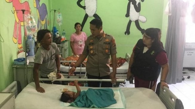 Buntut Kain Gendongan Terlilit, Kaki Balita Arman Terpaksa Diamputasi