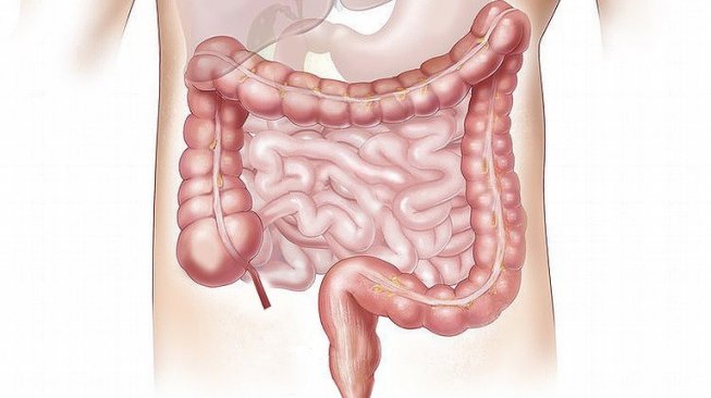 Ilustrasi usus, organ dalam tubuh (Pixabay/Elionas2)