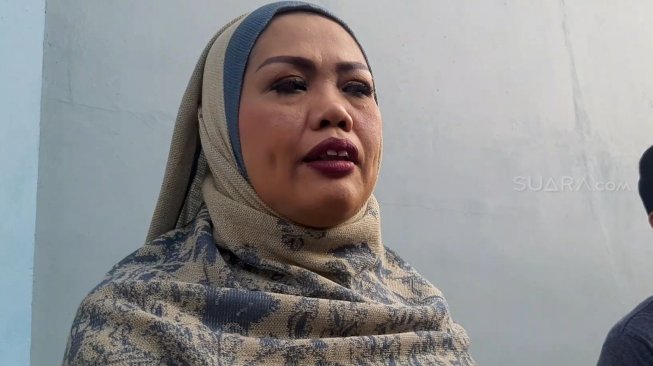 3 Potret Elly Sugigi usai Potong Gigi, Penuh Pujian