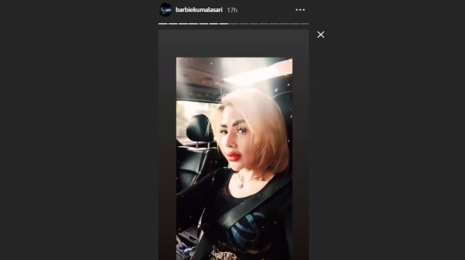 Barbie Kumalasari melakukan sulam bibir (Instagram/@barbiekumalasari)