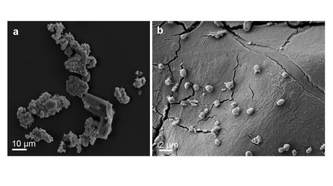 Mikroba pemakan bebatuan luar angkasa, Metallosphaera sedula. [Nature.com]