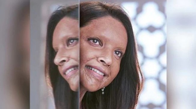 Trailer Film Chhapaak Dirilis, Deepika Padukone Nangis