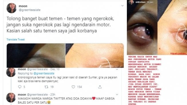 Viral Wanita Pejalan Kaki Kena Bara Rokok Pemotor, Matanya Jadi Merah