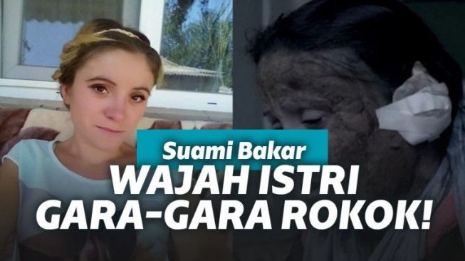 Kejam! Seorang Suami Tega Bakar Wajah Istri Karena Tidak Dibelikan Rokok