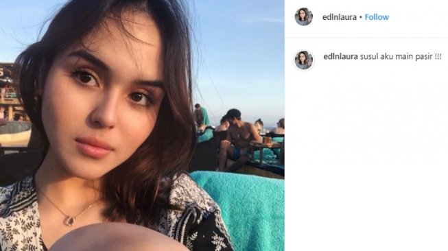 Minta Donasi untuk Operasi, Selebgram Laura Anna Dihujat Warganet