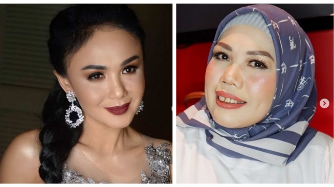 Yuni Shara Susah Orgasme, Elly Sugigi Potong Gigi