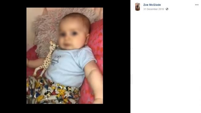 Bayi yang mengalami infeksi setelah dicium banyak orang (Facebook/Zoe McGlade)