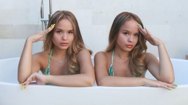 Si Kembar Christy dan Charly alias Cornell Twin. [Instagram]