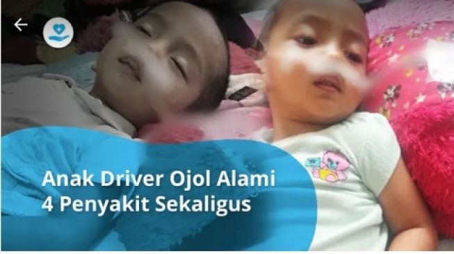 Kisah Pilu Supir Ojol, Anak Lahir dengan Empat Penyakit Butuh Uluran Tangan