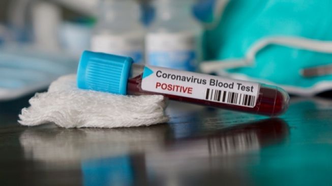 Novel Coronavirus (nCoV) alias virus corona yang sedang mewabah di China. (Shutterstock)