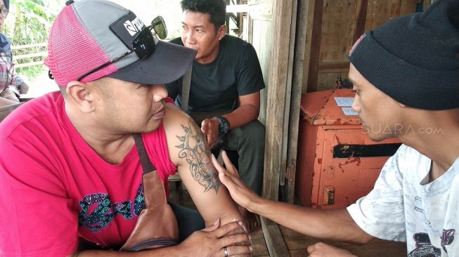 Salah seorang karyawan warung Kongsuu mengoles cairan khusus sebelum menghapus tato dengan laser di warung Kongsuu, Dusun Pringgen, Desa Widodomartani, Kecamatan Ngemplak, Kabupaten Sleman, Senin (10/2/2020). - (Suara.com/Baktora)