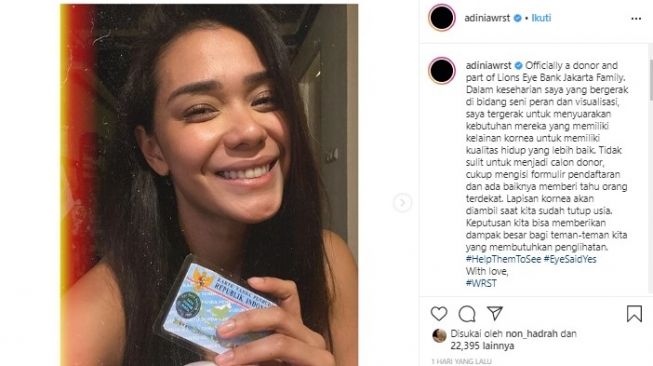 Adinia Wirasti menjadi calon donor kornea (Instagram/adiniawrst)