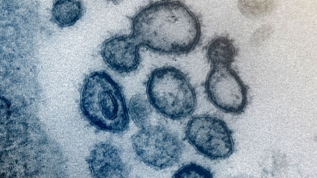 Mutasi Terbaru, Peneliti Sebut Virus Corona Covid-19 Melemah