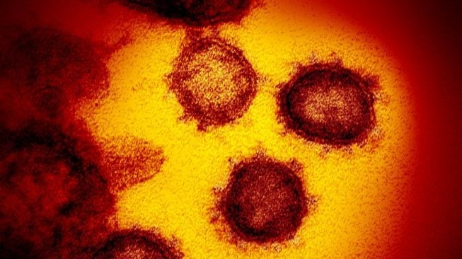 Virus corona (COVID-19) muncul dari permukaan sel manusia, credit: NIAID-RML