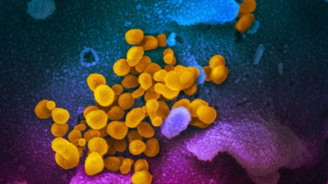 COVID-19 (yellow) among human cells (blue, pink and purple), credit: NIAID-RML