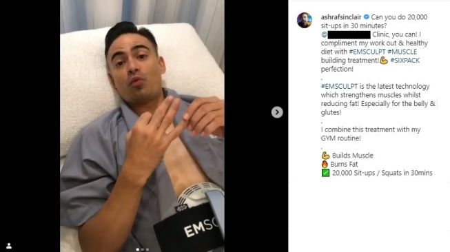 Ashraf Sinclair melakukan perawatan emsclupt (Instagram/@ashrafsinclair)